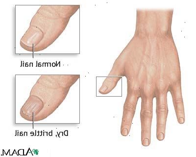 Hoe om te kijken na uw nagels. Bij de toepassing lotion op je handen zorg ervoor om wat wrijven in en rond je nagels.