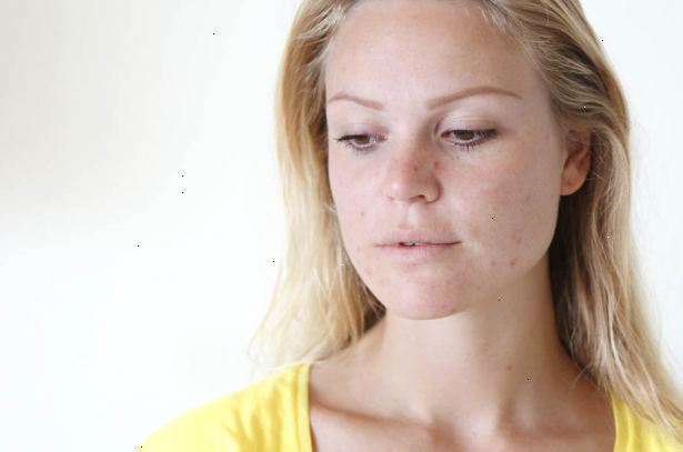 Hoe je make-up gezicht om acne te dekken toepassing. Was je gezicht grondig en voorzichtig met behulp van een acne-fighting gezicht te wassen elke ochtend.