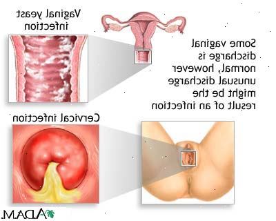 Hoe om te gaan met de menstruele geur. Gebruik gezondere menstruatie producten.